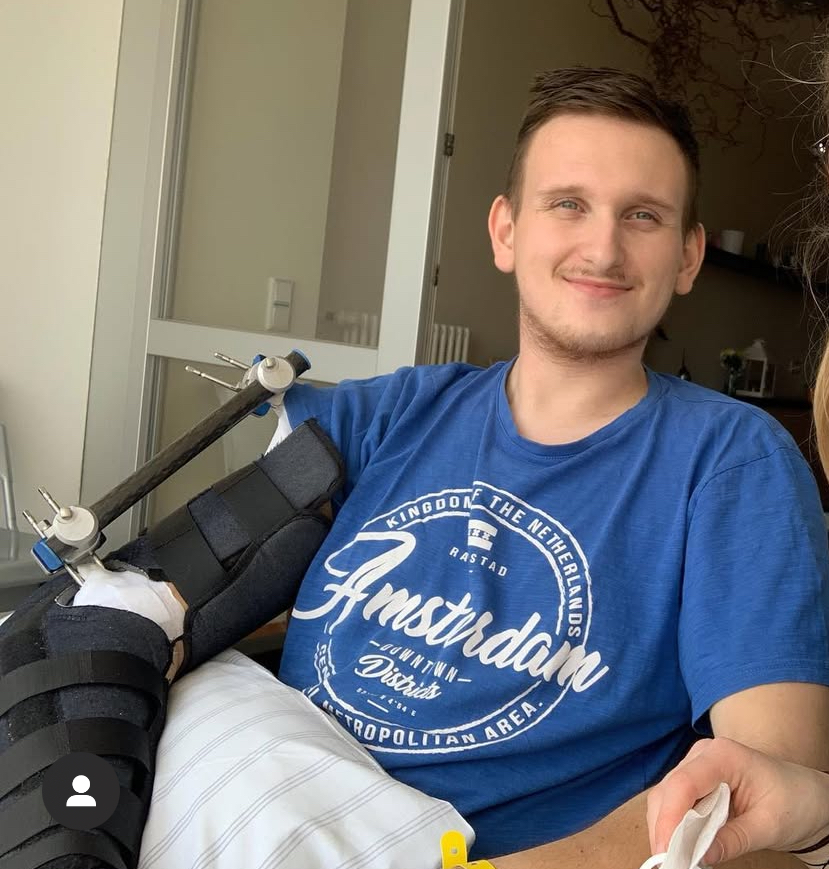 ONESTY Kunde Felix nach seinem Unfall mit gebrochenem Arm